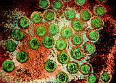 False-col TEM of hepatitis A virus