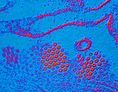 False-col TEM of hepatitis A virus particles