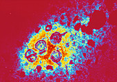 Hepatitis B virus particles