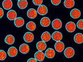 Coloured TEM of hepatitis B virus particles