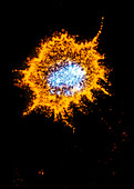 Immunofluorescent LM of prion proteins on cell