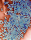 Arabis mosaic virus,TEM