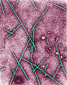 Barley yellow mosaic virus,TEM