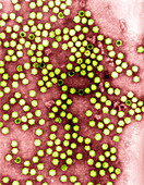Cowpea mosaic virus,TEM