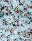 Maize chlorotic dwarf virus,TEM