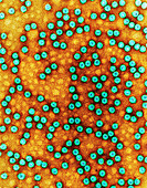 Brome grass mosaic virus,TEM