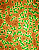 Brome grass mosaic virus,TEM
