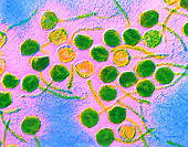 False-colour TEM of lambda bacteriophages