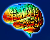 Computer art of brain with Alzheimer's disease