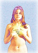 Image depicting a woman with breast cancer