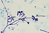 LM of Candida,found in sample of urine