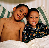 Boy with chickenpox sits in bed with brother