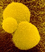 SEM of T-cell attacking two cancer cells