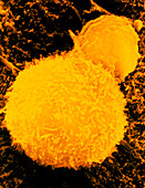 SEM of T-lymphocyte killer cell
