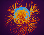F/col SEM of a cancer cell