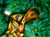 Immunofluorescent LM of melanoma cancer cells