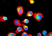 Immunofluorescent LM of LGLL leukaemia cells