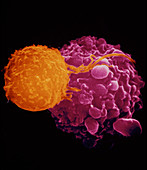 Coloured SEM of lymphocyte attacking cancer cell