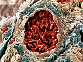 Colon cancer blood supply,SEM