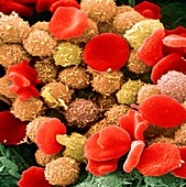 Leukaemia blood cells,SEM