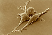 Smooth muscle cancer cells,SEM
