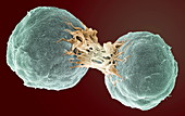 Dividing lymphoma cancer cells,SEM
