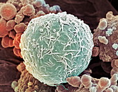 Leukaemia blood cell,SEM