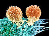 T lymphocytes and cancer cell,SEM