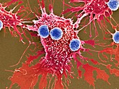T lymphocytes and cancer cells,SEM