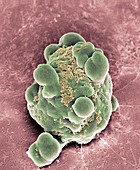 Cancer cell apoptosis,SEM