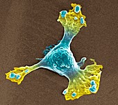 Skin cancer cell,SEM