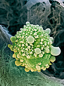 Pancreatic cancer cell,SEM