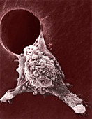 Metastasis of a cancerous cell,SEM