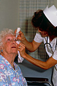 Nurse applying eye drops to an elderly woman