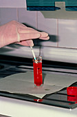 Urine test for haematuria by using a dipstick