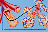 Heart disease: hypertension,atheroma,lung oedema