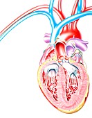 Artwork of heart in congestive heart failure