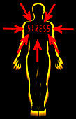 Stress and heart disease