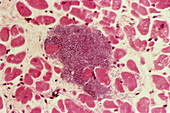 Infected heart tissue,light micrograph