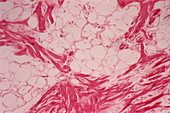 Heart fat deposits,light micrograph