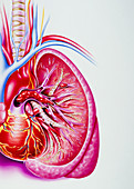 Artwork showing a pulmonary embolism
