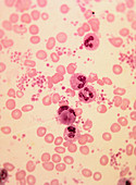LM of blood smear in lupus erythematosus