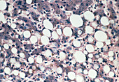 LM of a section through fatty liver