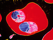 TEM of 2 merozites of the malaria parasite