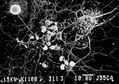 SEM of microglial cells ingesting oligodendrocytes