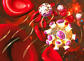 Artwork of infected red blood cells in malaria