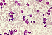 Malaria parasites