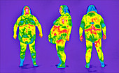 Obese woman,thermogram