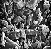 Pseudogout showing calcium phosphate crystals