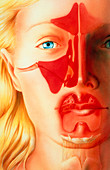 Artwork of facial sinuses & tonsils (sinusitis)